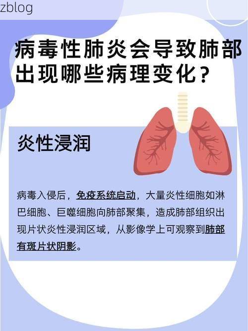 呼图壁新增1例无症状感染者  呼图壁县疫情防控工作最新通报