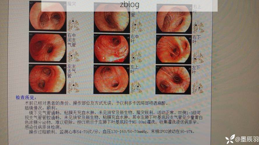 云安：粤西山区屏障下的低感染样本解析