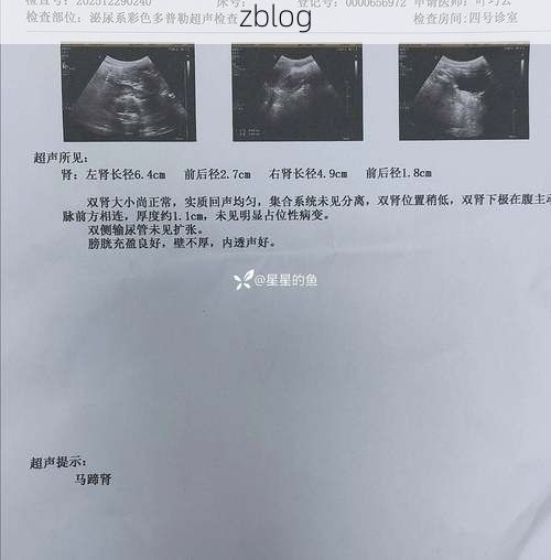 2022年3月31日曲靖市马龙区新增确诊病例情况