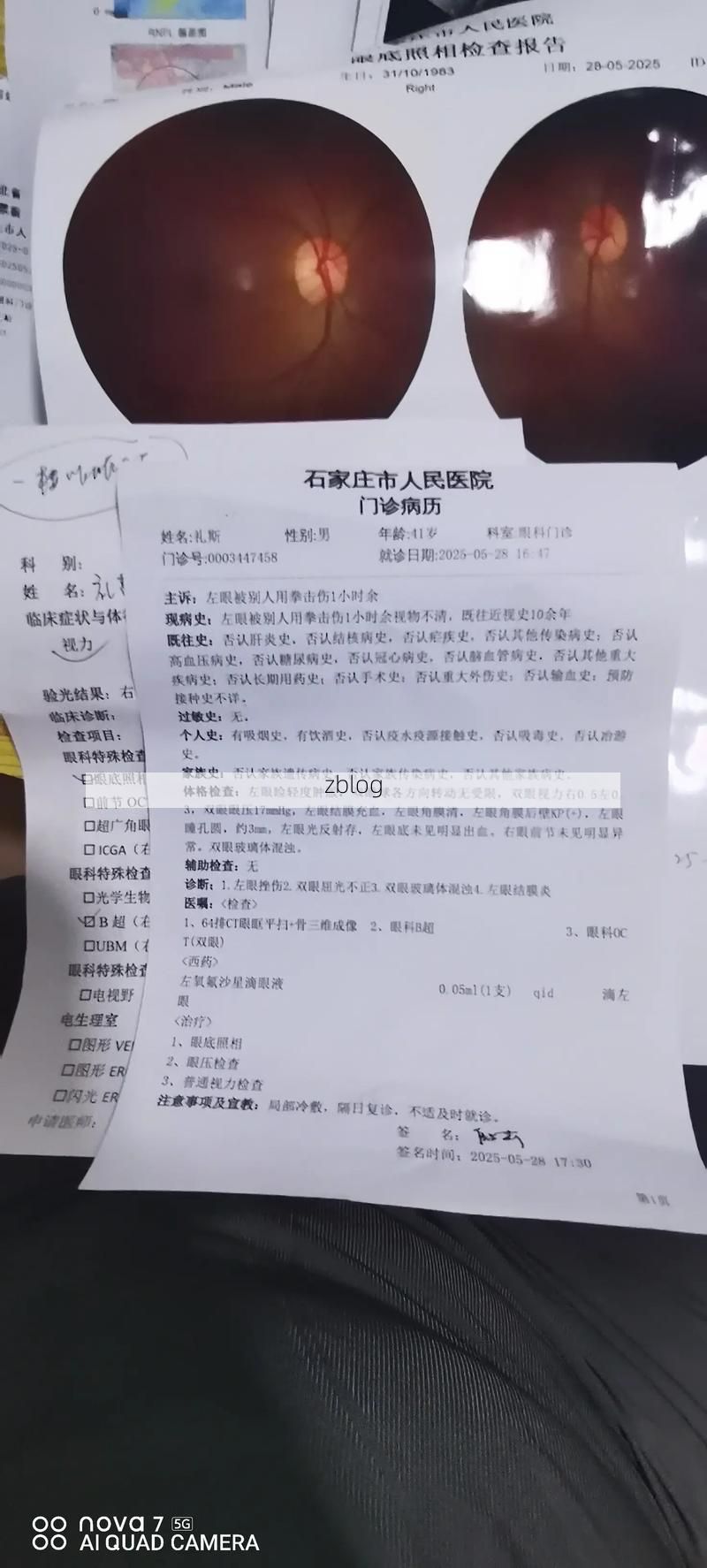 2022年11月25日贺兰县新增确诊病例情况_25874