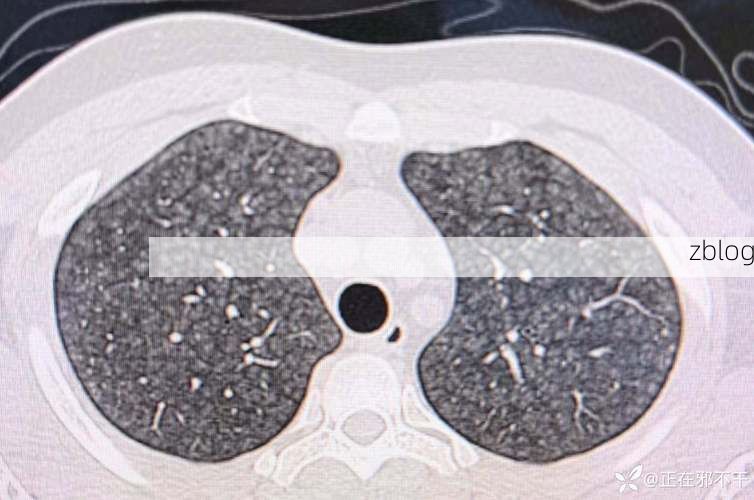 万山疫情观察：高原屏障下的零感染样本