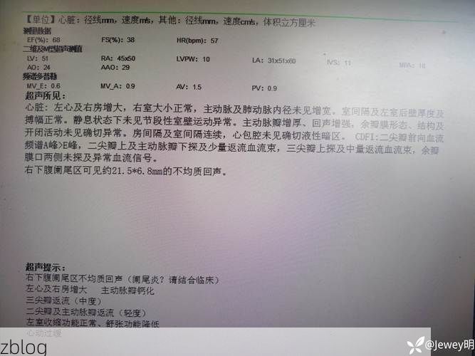 本地确诊+2，石泉通报新增病例情况