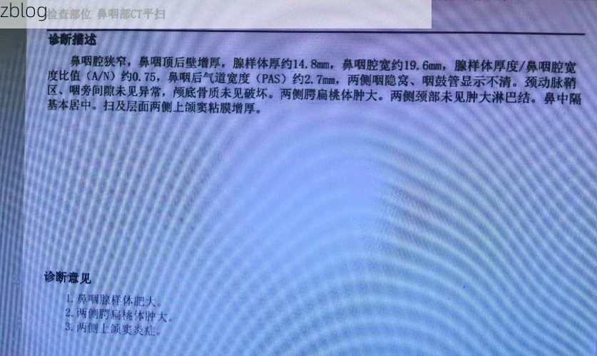 本地确诊+1，玛纳斯县通报新增病例情况