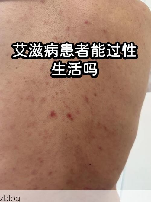 元谋干热河谷的防疫屏障：地理优势如何阻隔病毒传播？