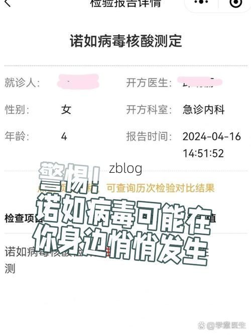 玉门新增1例无症状感染者  玉门市疫情防控最新通报