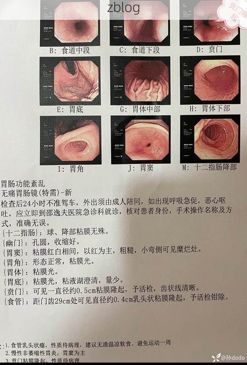 本地确诊+1，吉隆通报新增病例情况