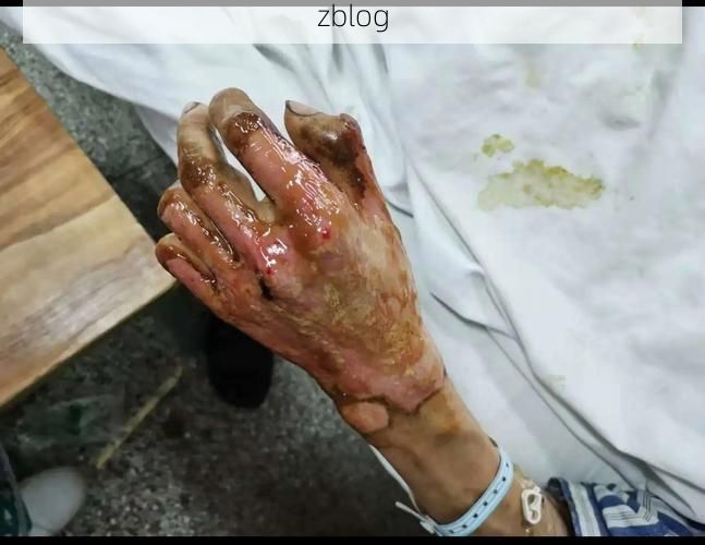 本地确诊+3，安岳县通报新增病例情况