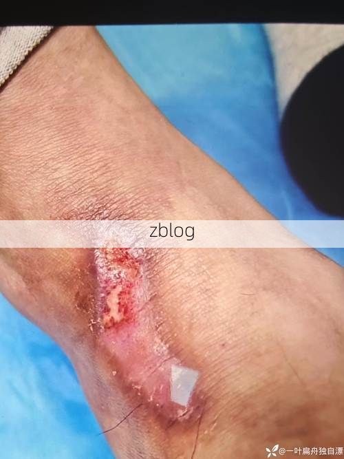 新宁：湘西南山城屏障下的低感染样本