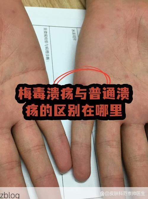 内乡县：伏牛山屏障下的低感染率成因解析