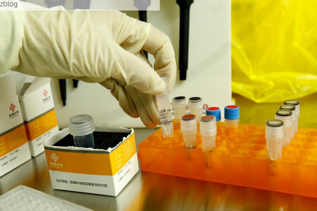 峨眉山新增1例无症状感染者  峨眉山疫情防控最新通报_22256